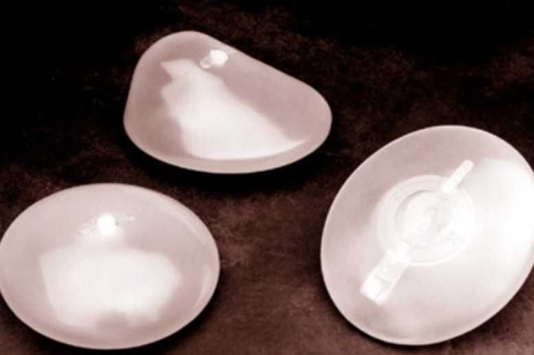 France Recalls 30 000 Breast Implants Amid Cancer Fears Hospitals Healthcare Global